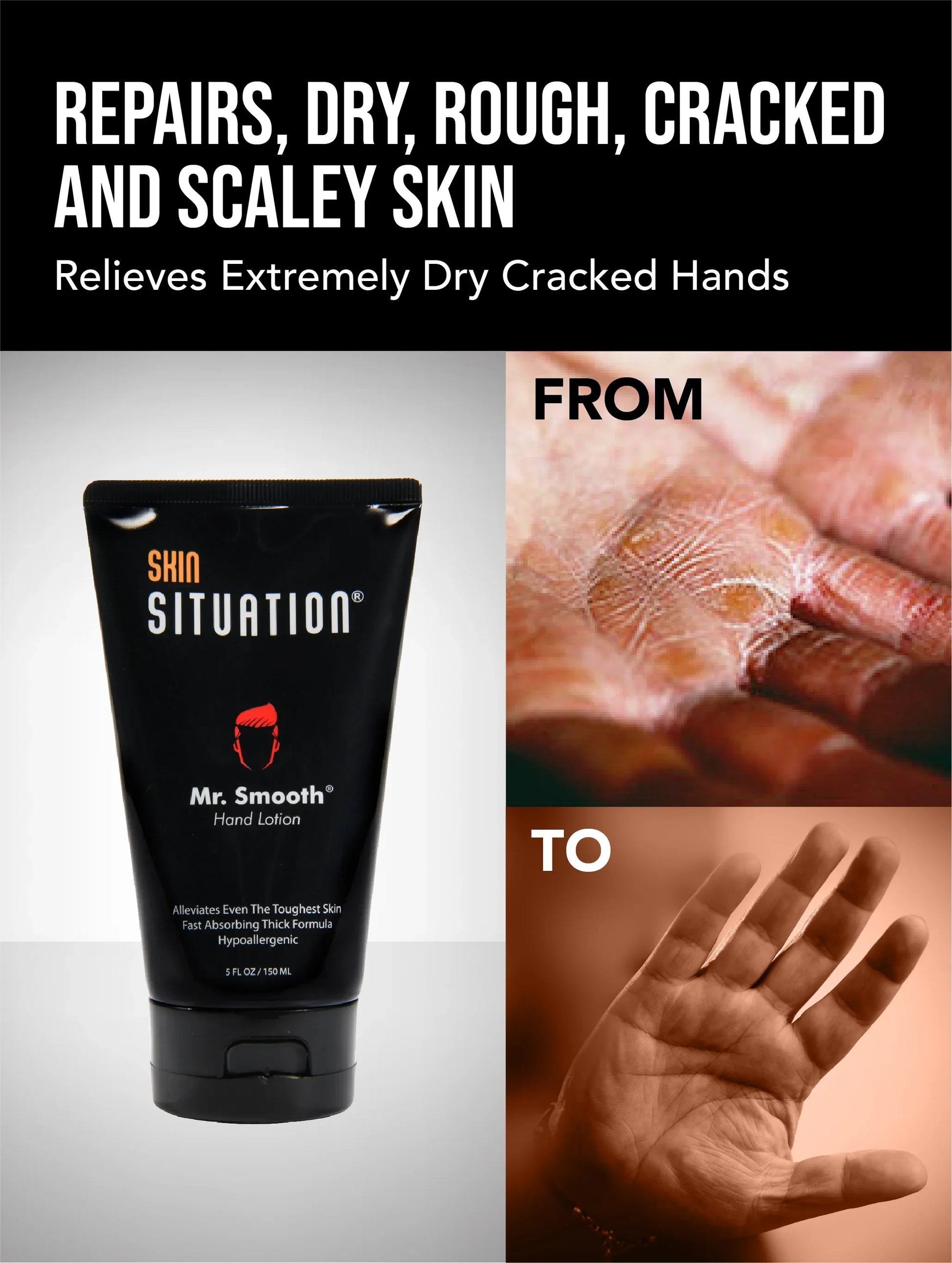 Hand lotion tube for repairing dry